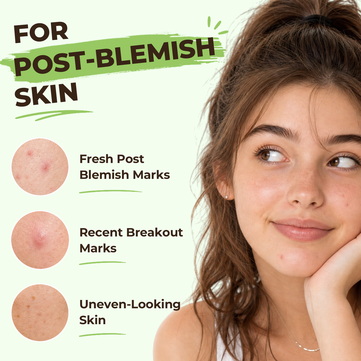 Microdart Dark Spot Patches for Post-Blemish Marks